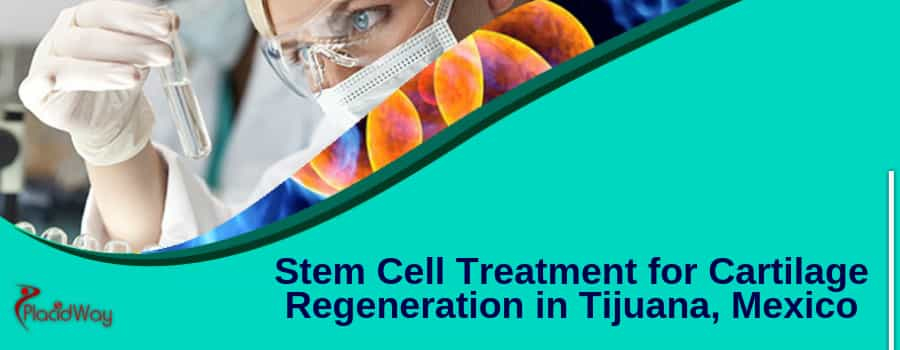 Stem Cell Treatment for Cartilage Regeneration in Tijuana, Mexico